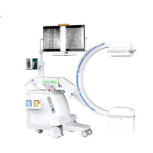 Mobile Digital FPD C-Arm-System Raidographie Röntgenlumbal Wirbel Fluoroskopie PLX118C